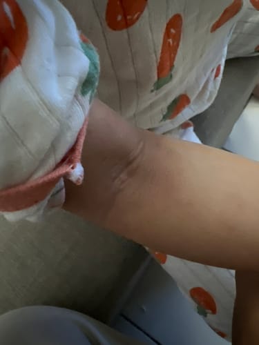 Customer photo review of Jolicare Cream