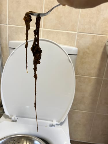 Customer photo review of Paragon | Parasite Cleanse