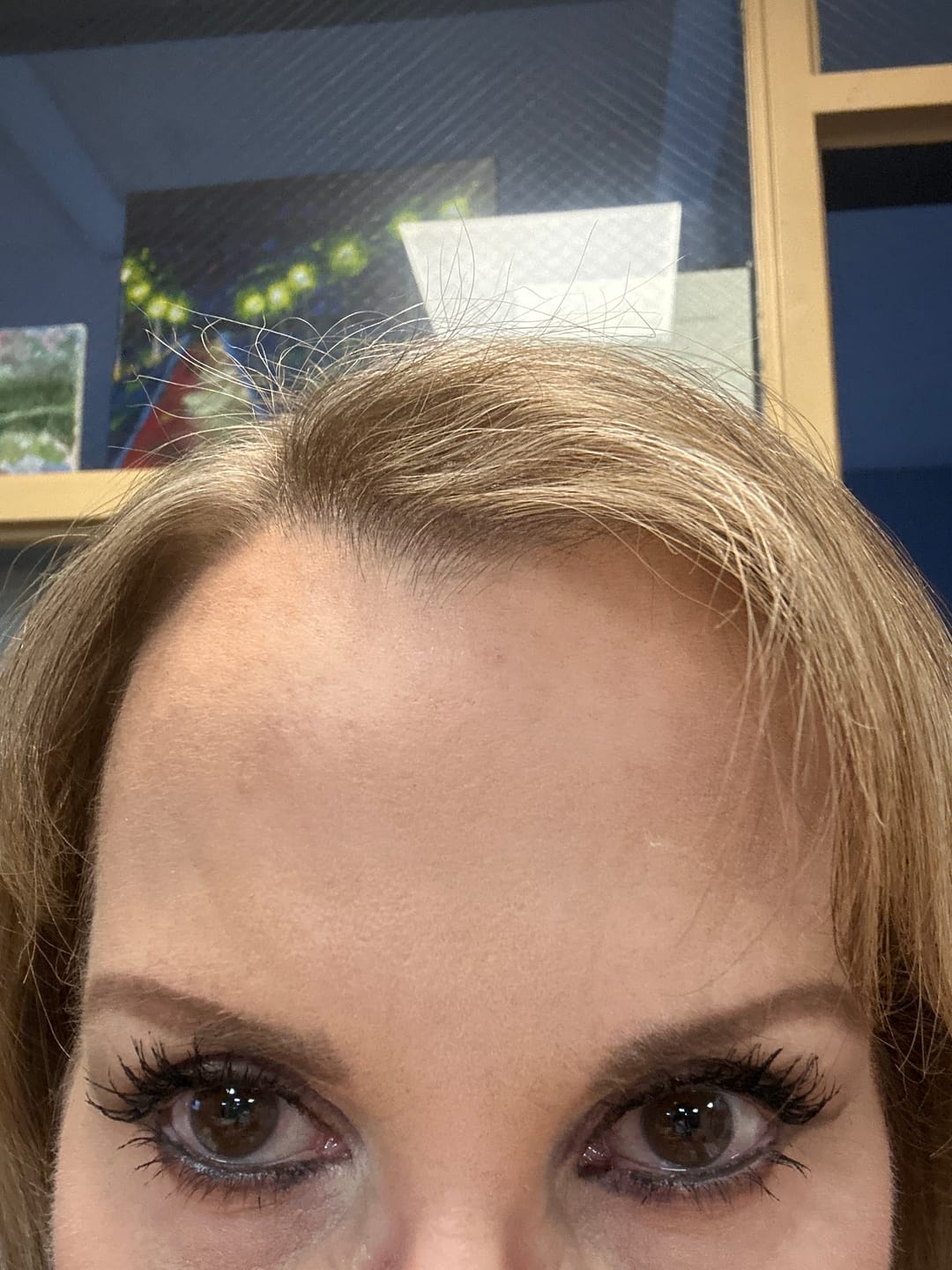 Customer photo review of EYELASH GROWTH SOLUTION