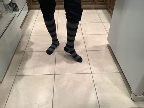Customer photo review of YoU Compression® Stripes Collection Knee High 20-30 mmHg