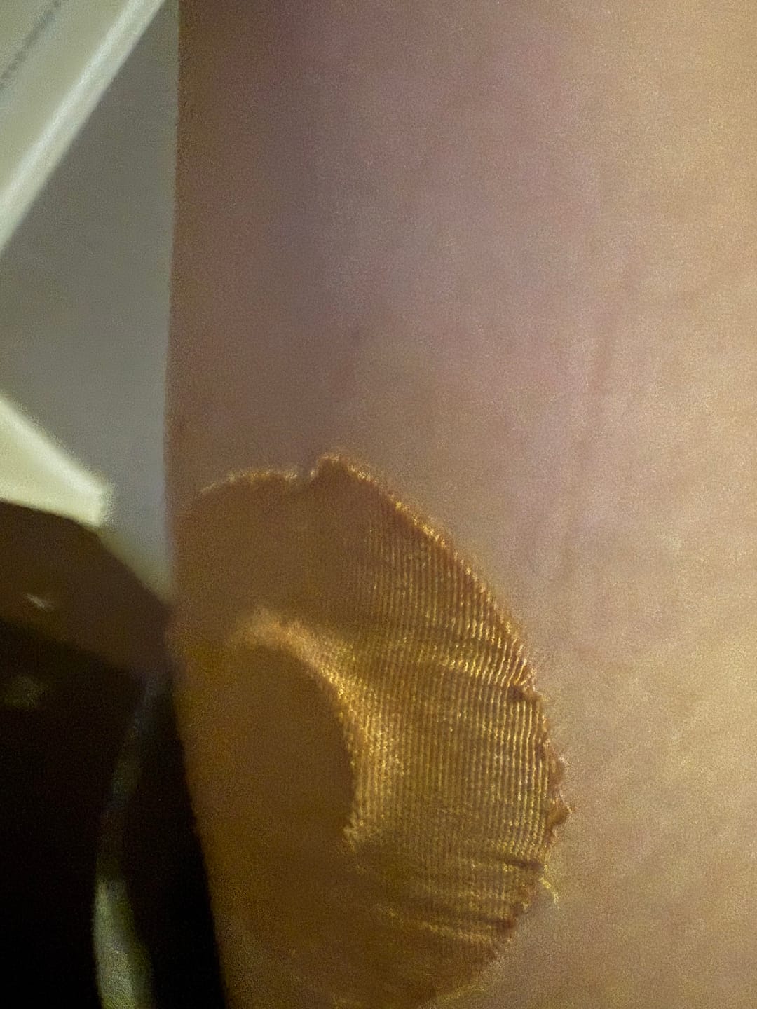 Customer photo review of Skin Grip Original - Freestyle Libre 2 & Lingo Adhesive Patches