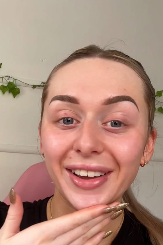Customer photo review of Retinol 1% Serum  (Vitamin A) (30ml)