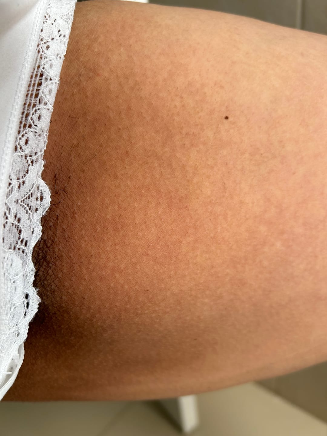 Customer photo review of Bright Skin Bish