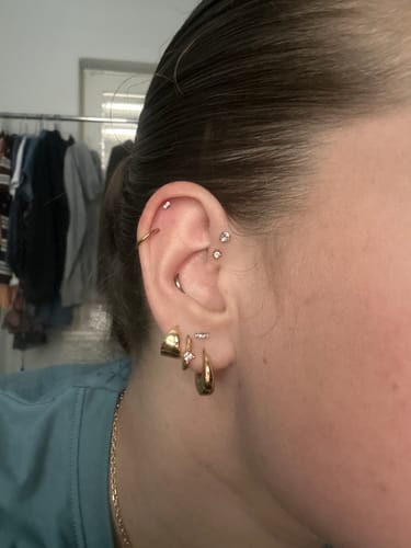 Customer photo review of Staple Huggies