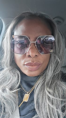 Customer photo review of Target Area Cream