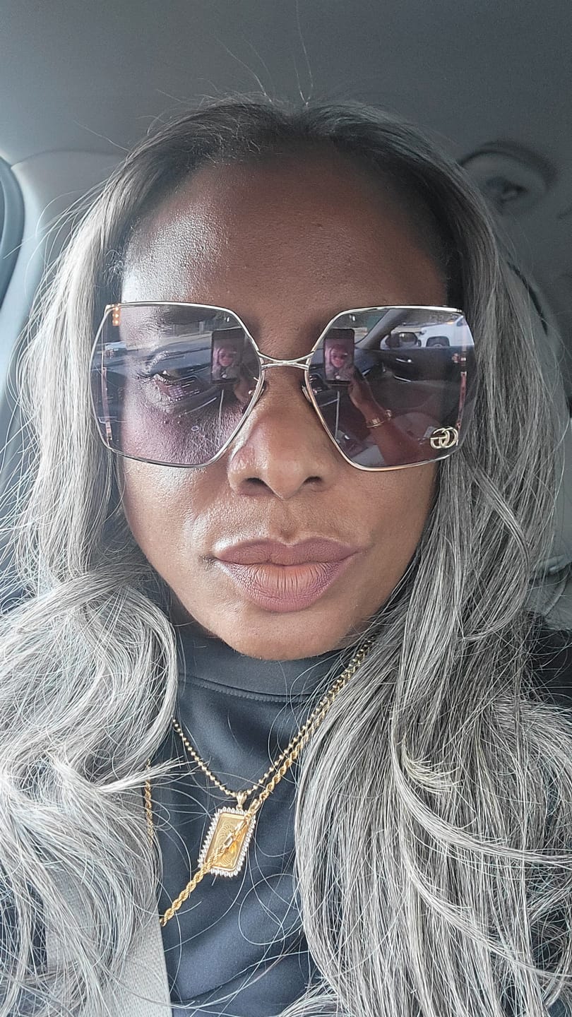 Customer photo review of Target Area Cream