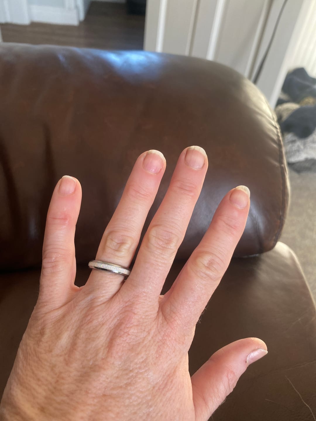 Customer photo review of The Original White Opal 4mm Wonder Ring