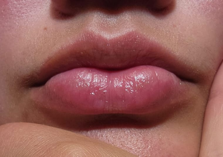 Customer photo review of Honeybalm Cherry