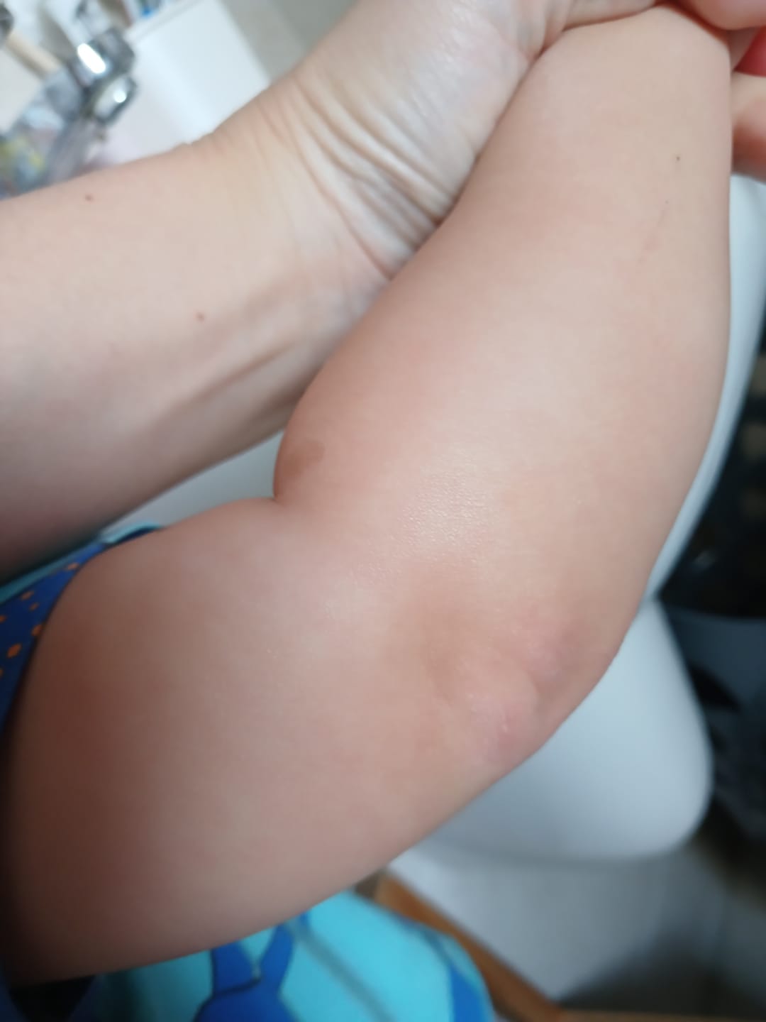 Customer photo review of Bioskin Junior Daily Nourishing Spray
