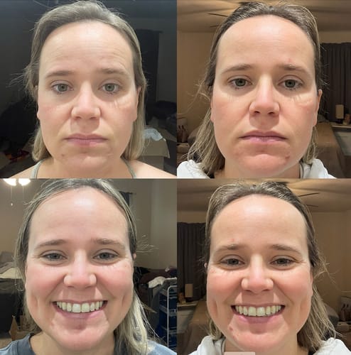 Customer photo review of The Complete System for Mature Women’s Skin