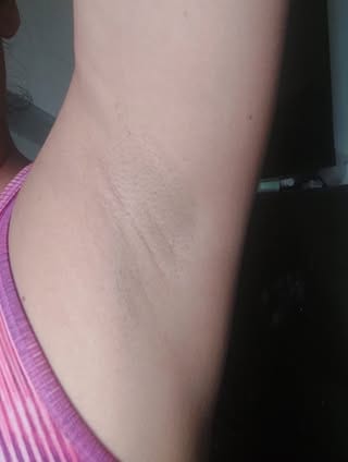 Customer photo review of SkinUp Clásica