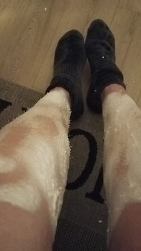 Customer photo review of 3x Belle Body Haarentfernung