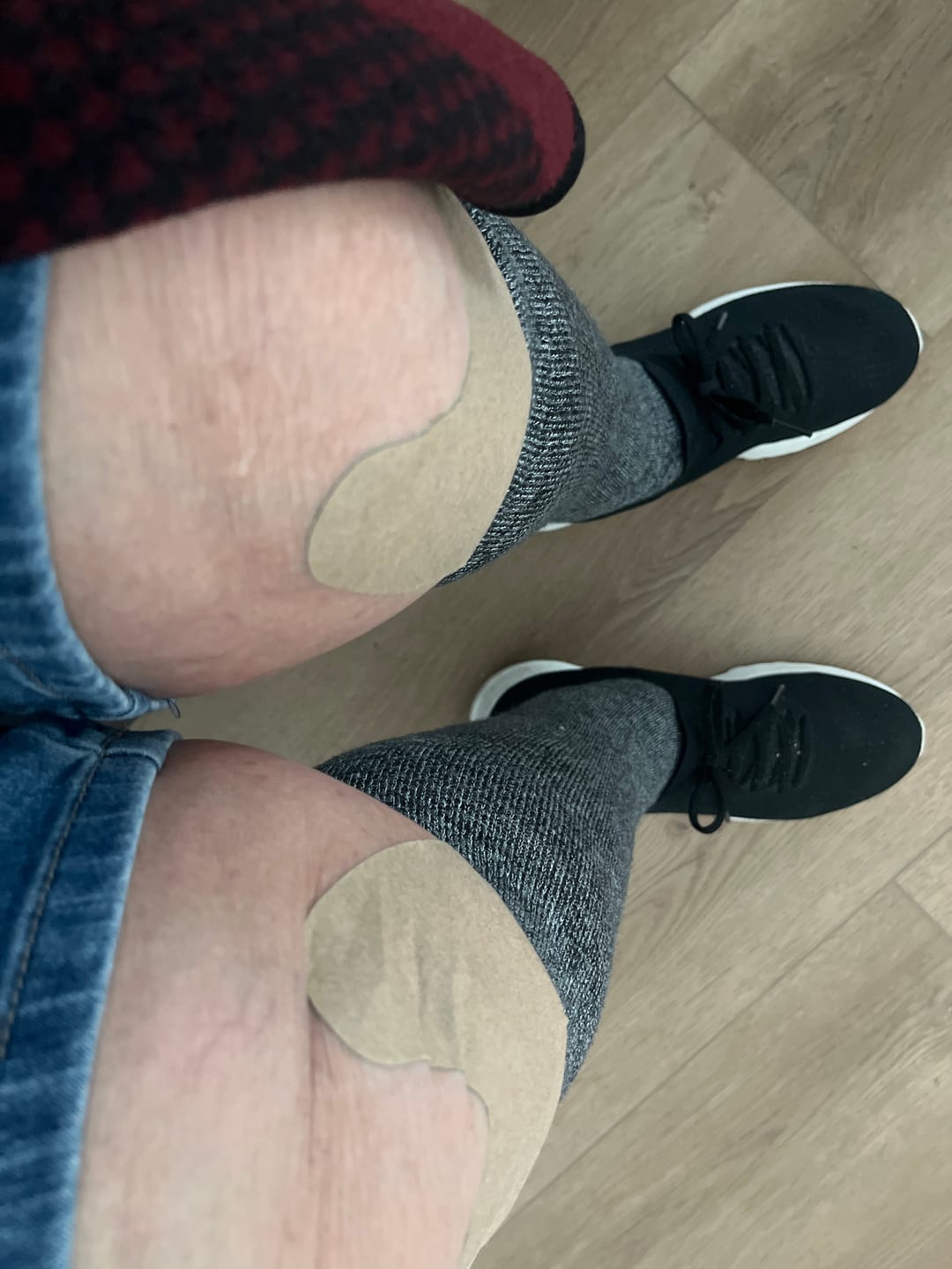 Customer photo review of Auxillium Knee Patch (fka Heaven Patch)