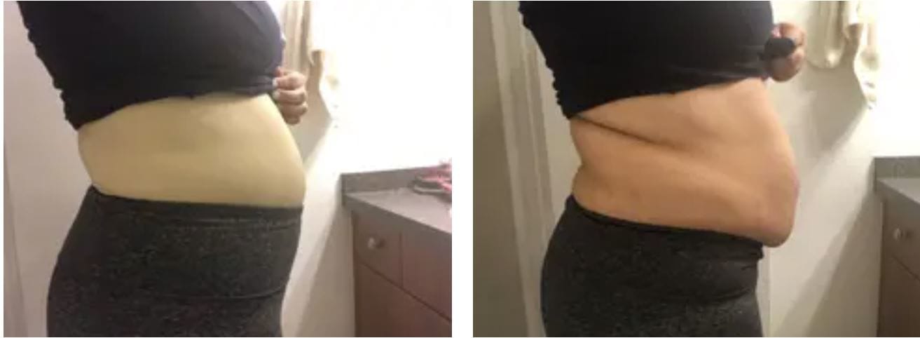Customer photo review of Culotte post-partum apaisante