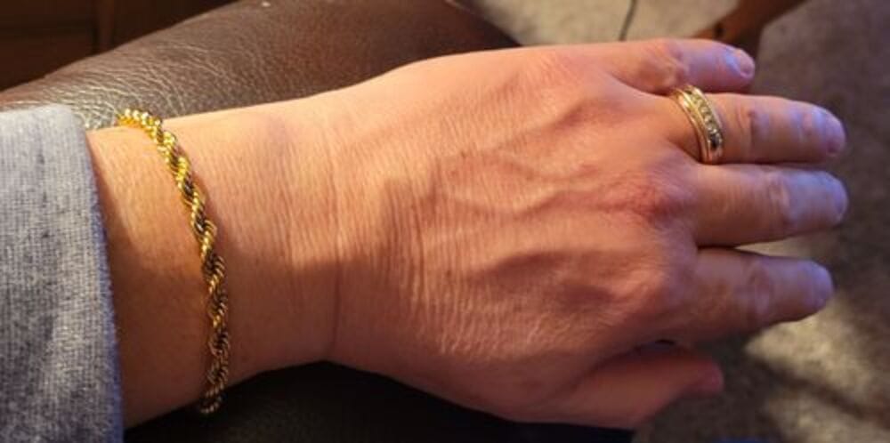 Customer photo review of ROPE BRACELET - GOLD (5𝘮𝘮)