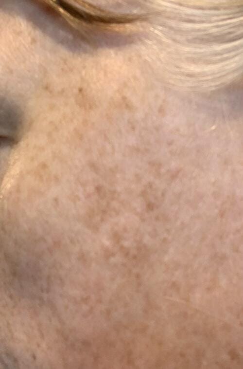 Customer photo review of Age Defying Trio