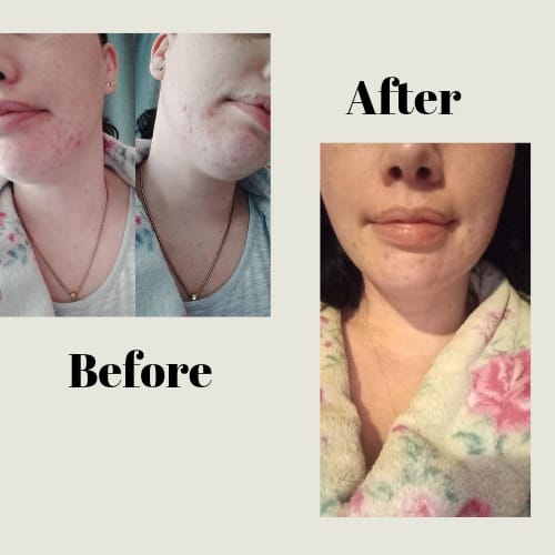 Customer photo review of Anti-Wrinkle Serum