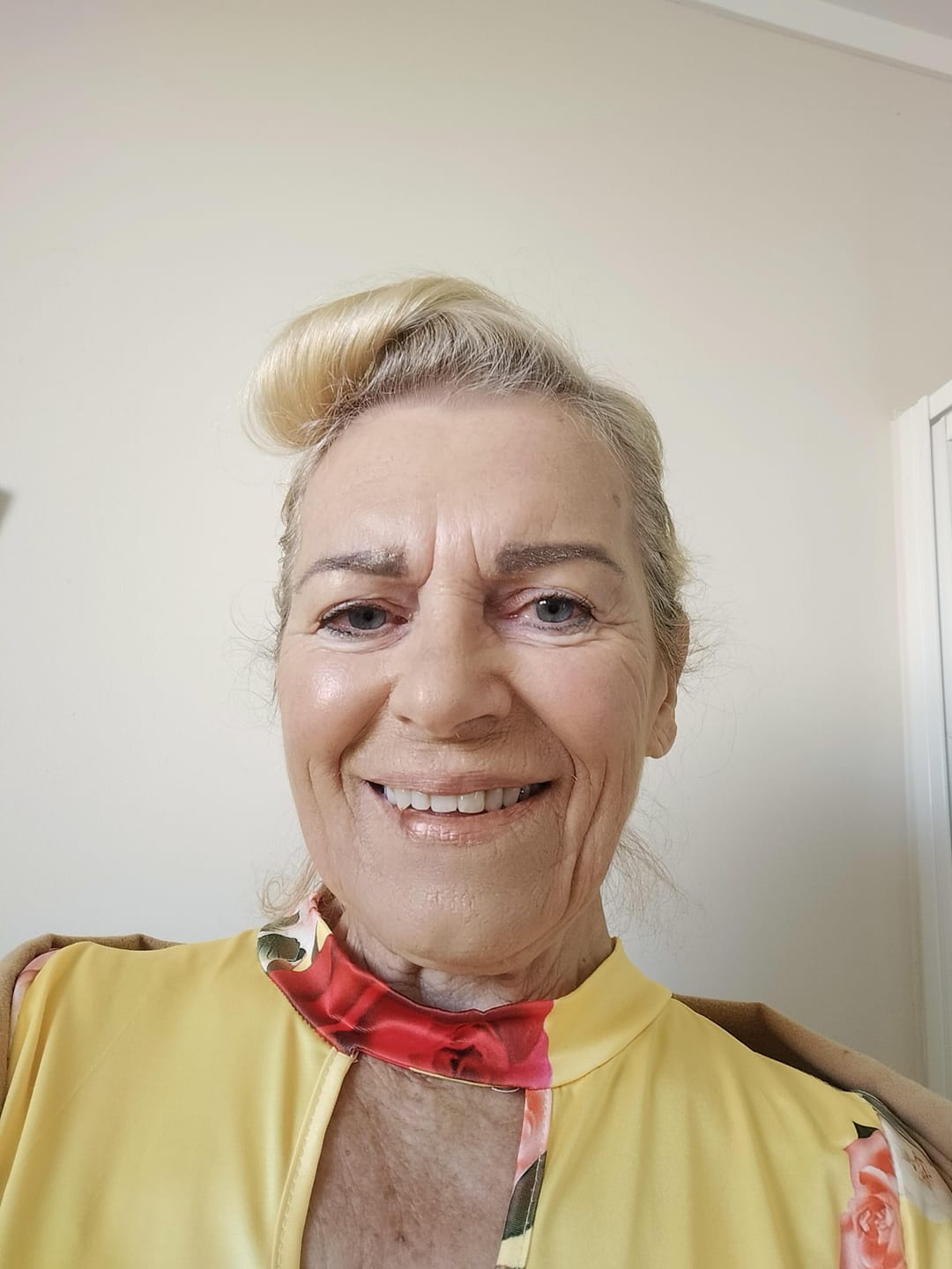 Customer photo review of Anti-Wrinkle Serum