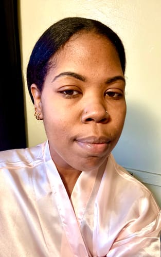 Customer photo review of WrinkleFix: Unlimited Toxins Membership