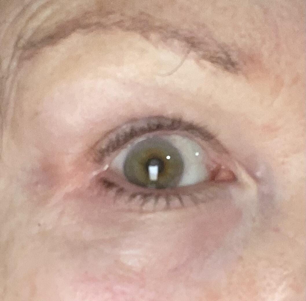 Customer photo review of Eye Creme
