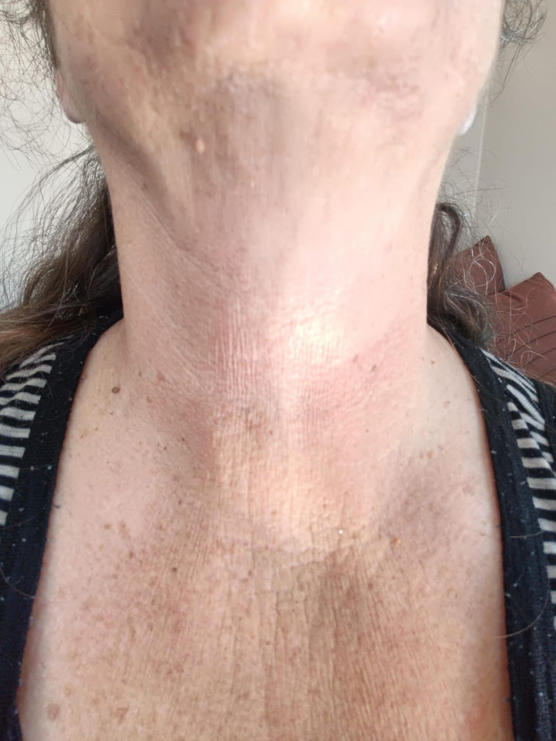 Customer photo review of Glow Booster