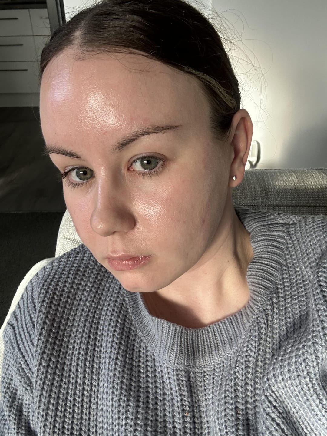 Customer photo review of Acne Clear Kit