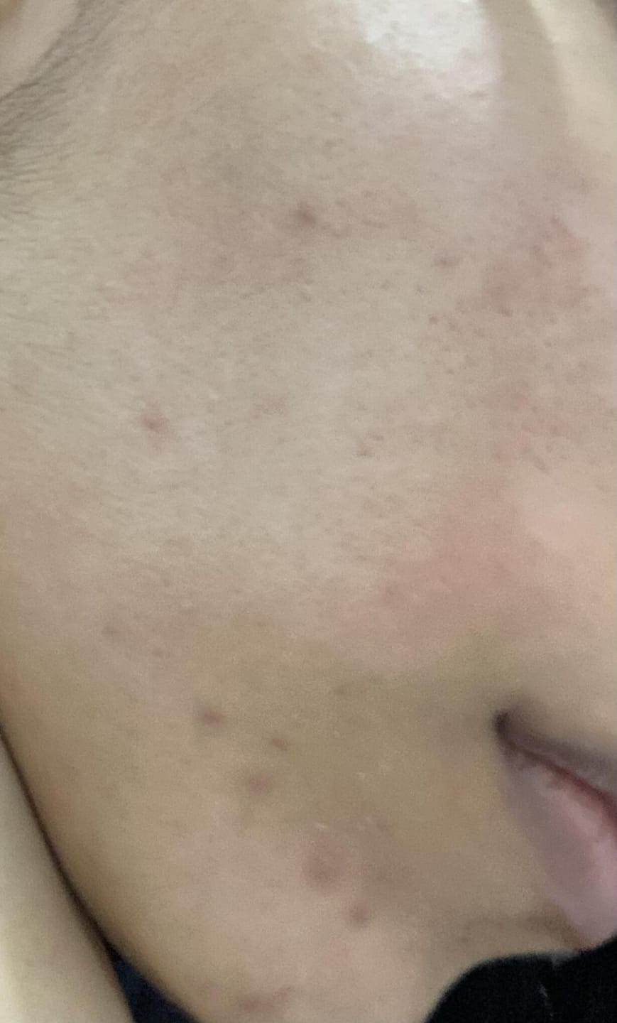 Customer photo review of Brightening Serum