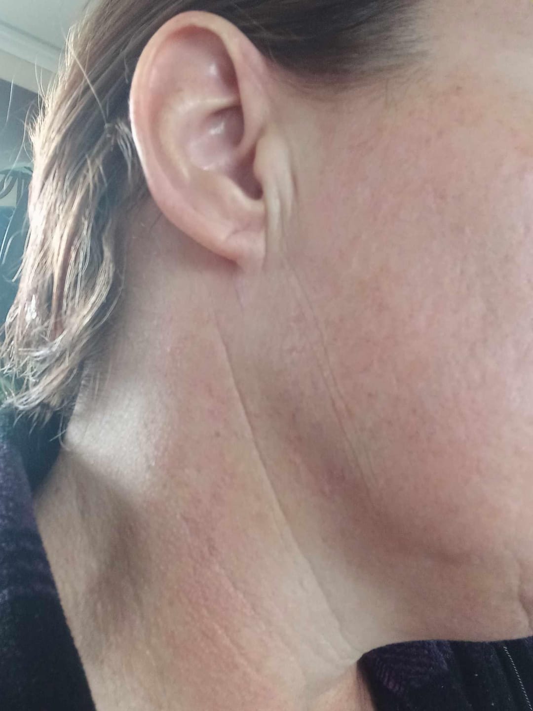 Customer photo review of Transformation Kit