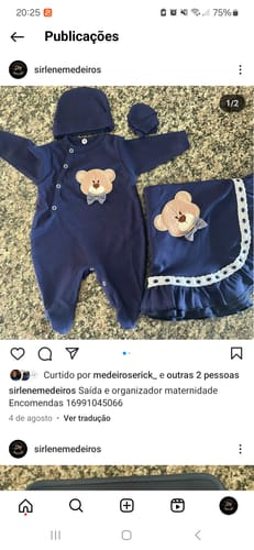 Customer photo review of PONTEIRAS PARA ALÇA 30MM DOURADO 10 PEÇAS