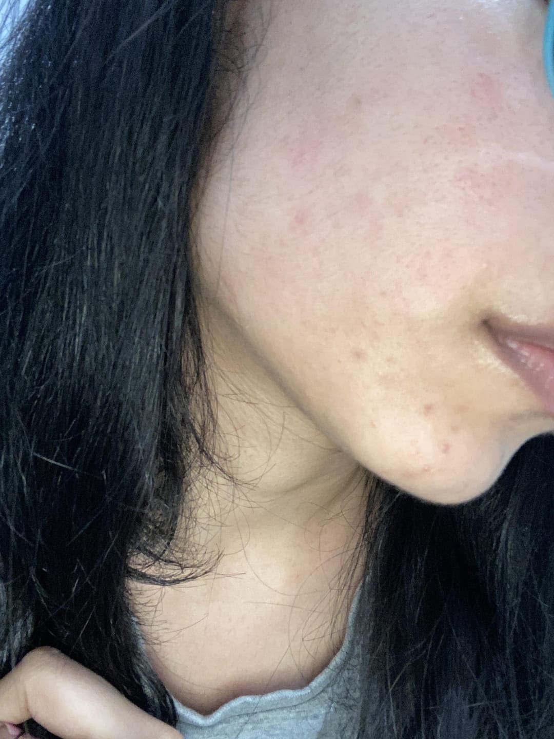 Customer photo review of Gel Cleanser