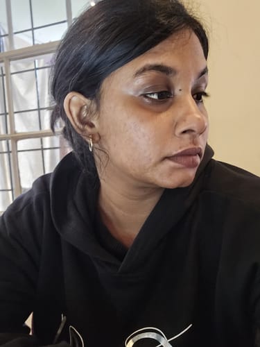 Customer photo review of The Super Glo Hydro Boost Jelly Moisturiser