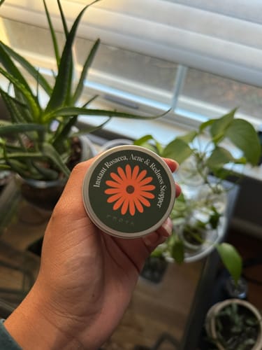 Customer photo review of Instant Rosacea, Acne & Redness Stopper