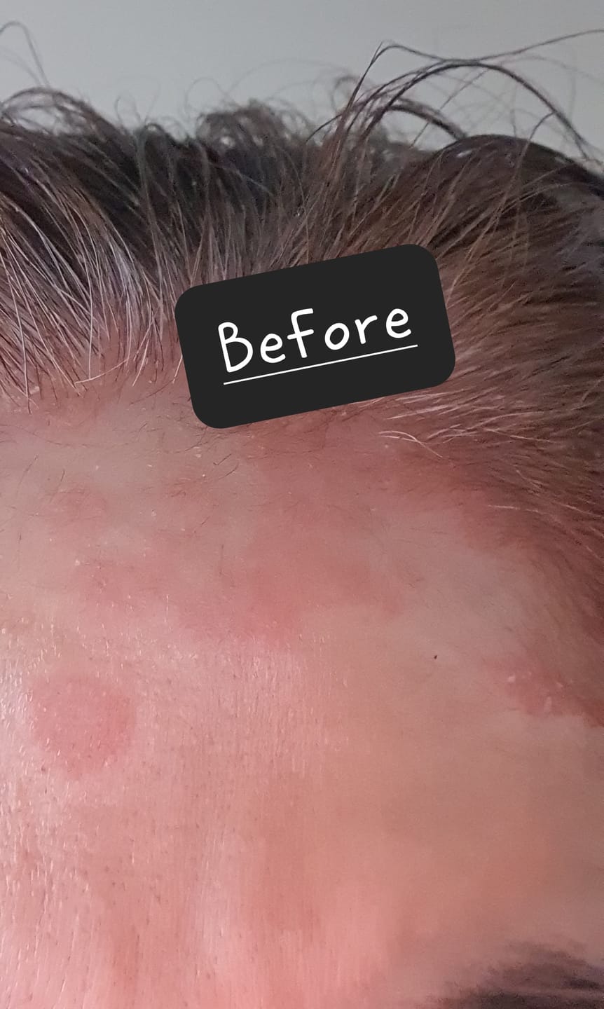 Customer photo review of Intensive Night Balm