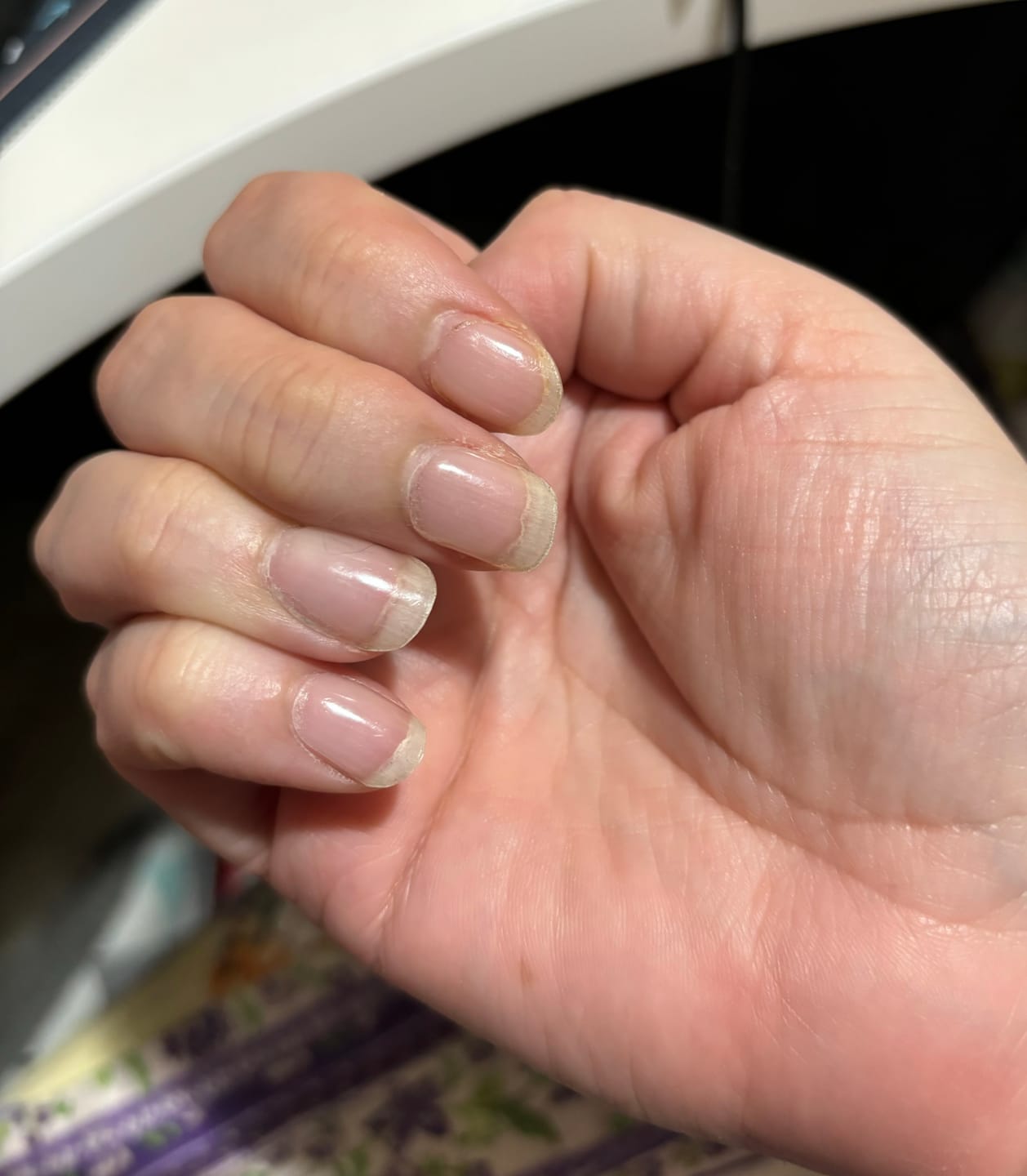 Customer photo review of Crystal Clear DIY Semicured Gel Nail Sticker Kit (STOP NAIL BITING & GROW BRITTLE NAILS)