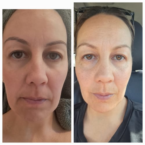 Customer photo review of Dry/ Mature Skincare Ritual