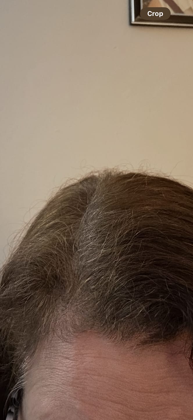 Customer photo review of Complex10™ Hair Growth Supplement
