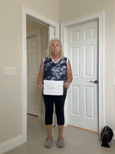 Customer photo review of Semaglutide Weight Loss Program