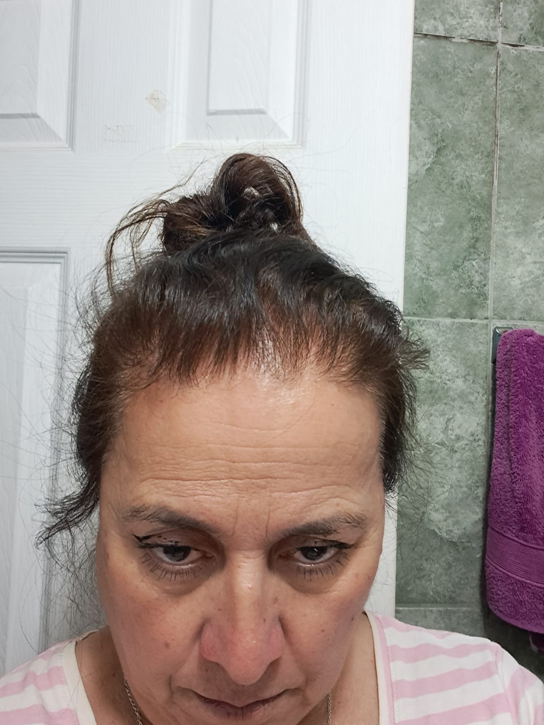 Customer photo review of 3 MESES de DÚO ANTIcaída CRECIMIENTO INTENSIVO Bomba + Tónico