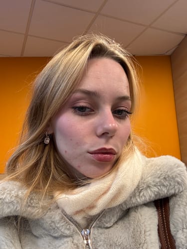 Customer photo review of peptide lip tint / ribbon