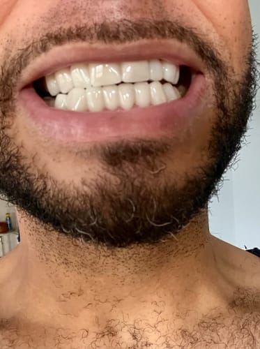 Customer photo review of Impression set