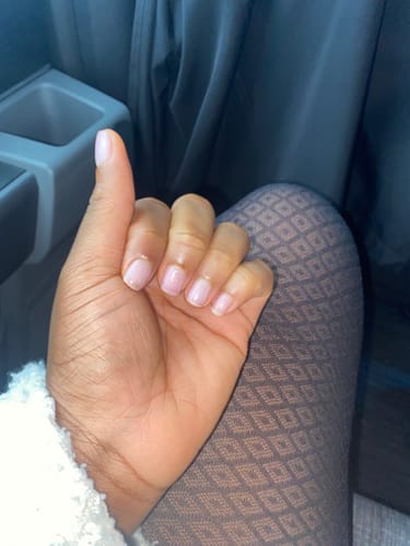 Customer photo review of Fair and White So White! Skin Perfector Gel 30ml