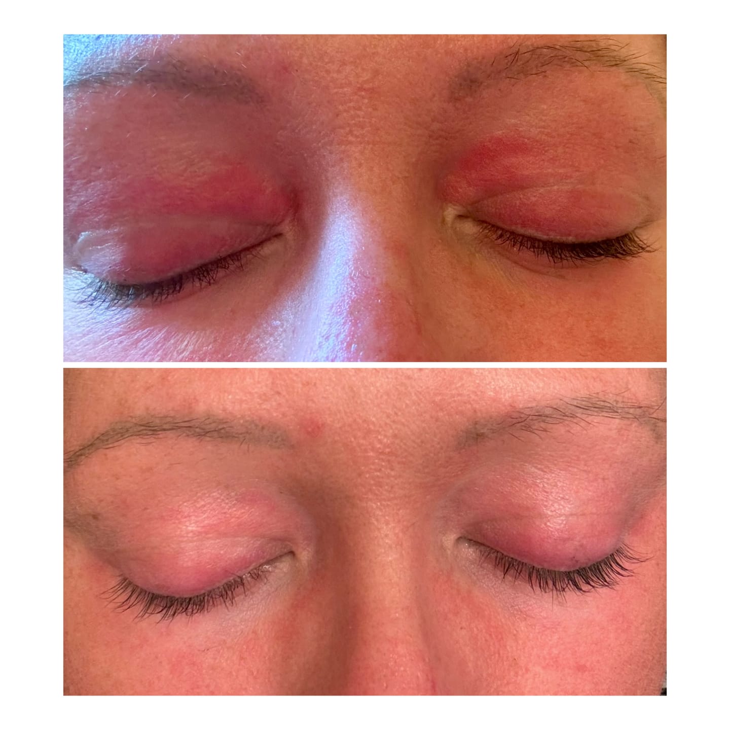 Customer photo review of EYELASH GROWTH SOLUTION