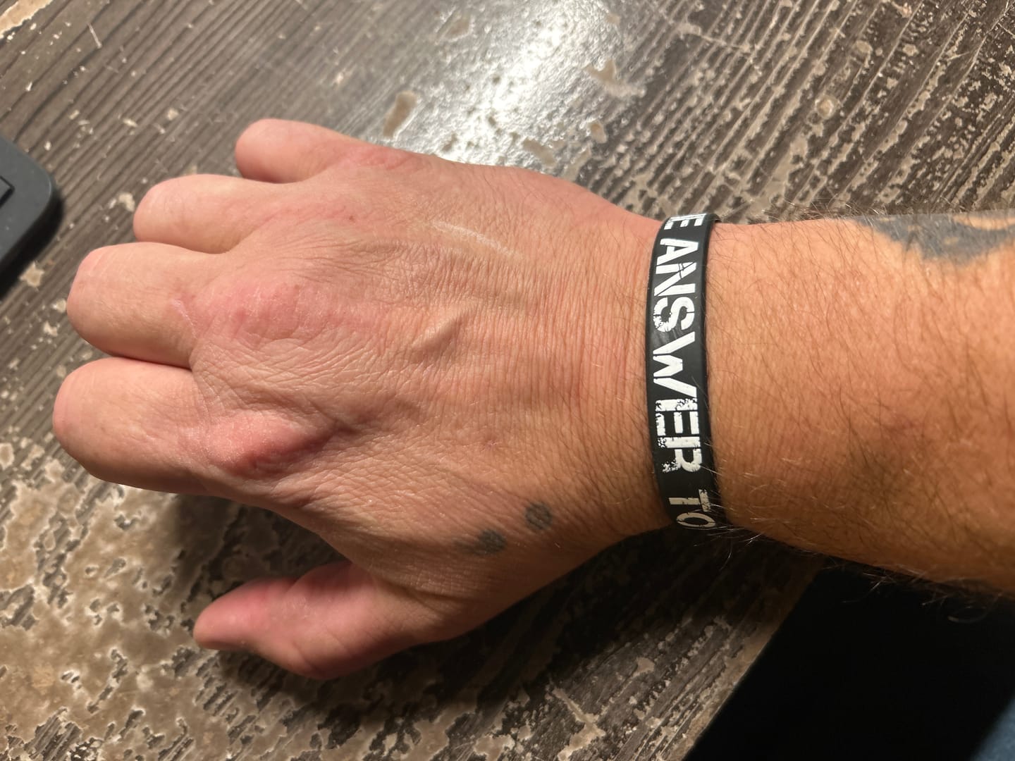 Customer photo review of The Answer to 1984 Wristband
