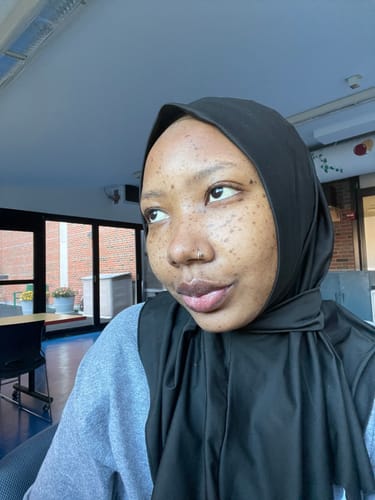 Customer photo review of Caramel System for Normal & Sensitive Skin Types