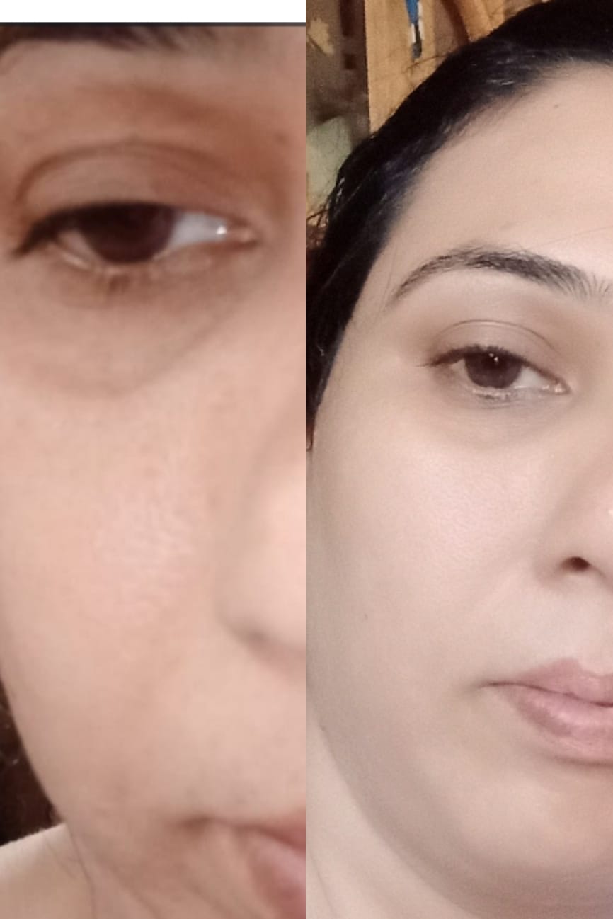 Customer photo review of Dermive Hydrating Serum