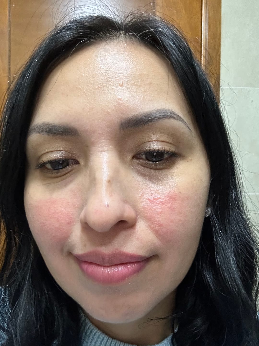 Customer photo review of Sérum Reafirmante Multi-Beneficios Centella Asiática 30ml -AMPLEN