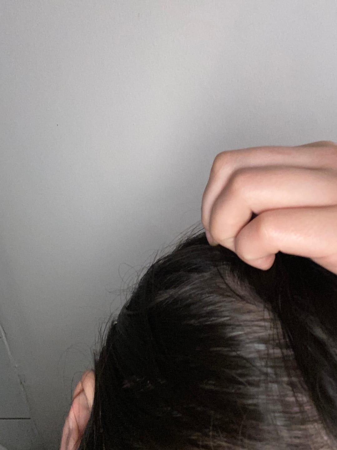 Customer photo review of Pack Anticaída de Cabello para 1 Mes