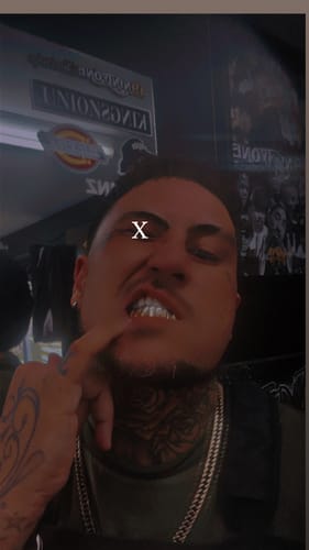 Customer photo review of NEXIUM (SILVER GRILLZ)