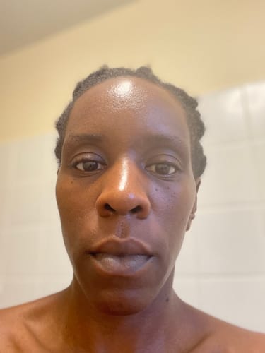 Customer photo review of Anti-Acne & Dark Spots African Soap