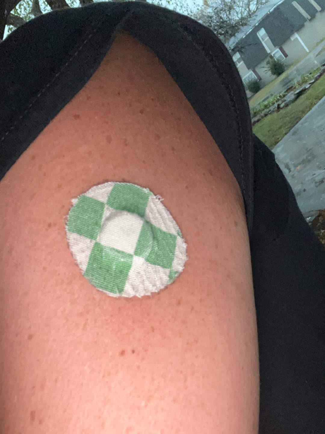 Customer photo review of Skin Grip Original - Libre 3 Adhesive Patches